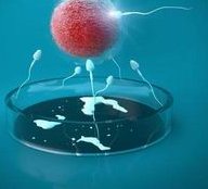 俄罗斯做试管准备什么？